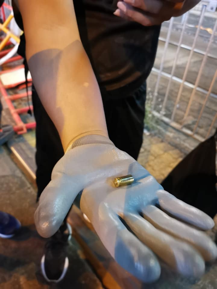 元朗發生14歲男童遭便衣警員開槍射傷左大腿事件。 圖：翻攝Tommy Cheung 張秀賢臉書