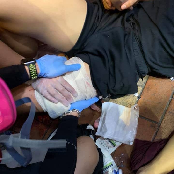 香港警方5日表示，4日晚間9時許，大批「暴徒」在元朗圍毆一名便衣警員，警員生命受嚴重威脅，為保護自身安全曾開一槍。這名少年也因涉嫌參與暴動和襲警被捕。 圖/立場新聞