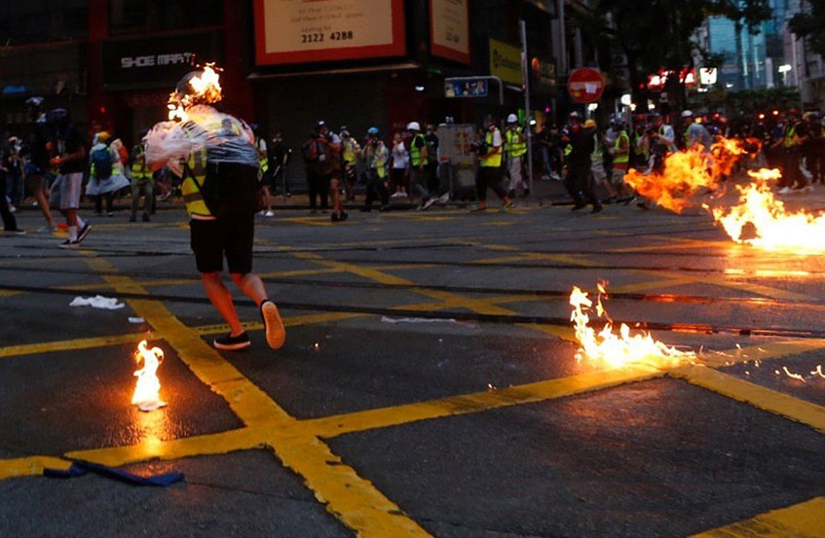 該名遭汽油彈波及的記者身上雨衣著火、左邊臉部燒傷。 圖 :	翻攝自香港城市大學學生會城市廣播（CBC）