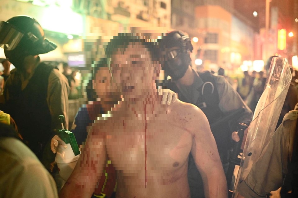香港1013暴發嚴重警民衝突，有人被打到頭破血流。 圖：翻攝StandNews立場新聞