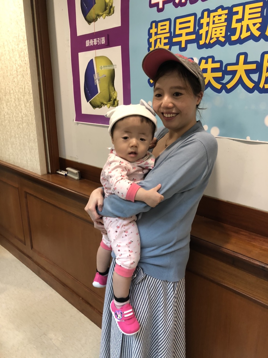 吳小妹頭型和一般寶寶不太一樣，眉骨比較凹陷，頭顱也寬扁，經醫生確診為罹患了罕見的「多條顱縫早閉症」。 圖／記者劉雅文拍攝