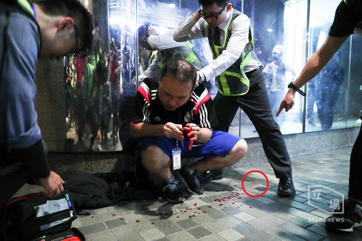 香港「反警暴七區行街（逛街）」行動，爆發流血襲擊事件，區議員趙家賢為制止灰衣男子持刀傷人時，反遭咬掉一部分左耳，現送醫等候縫合手術。 圖／取自立場新聞臉書