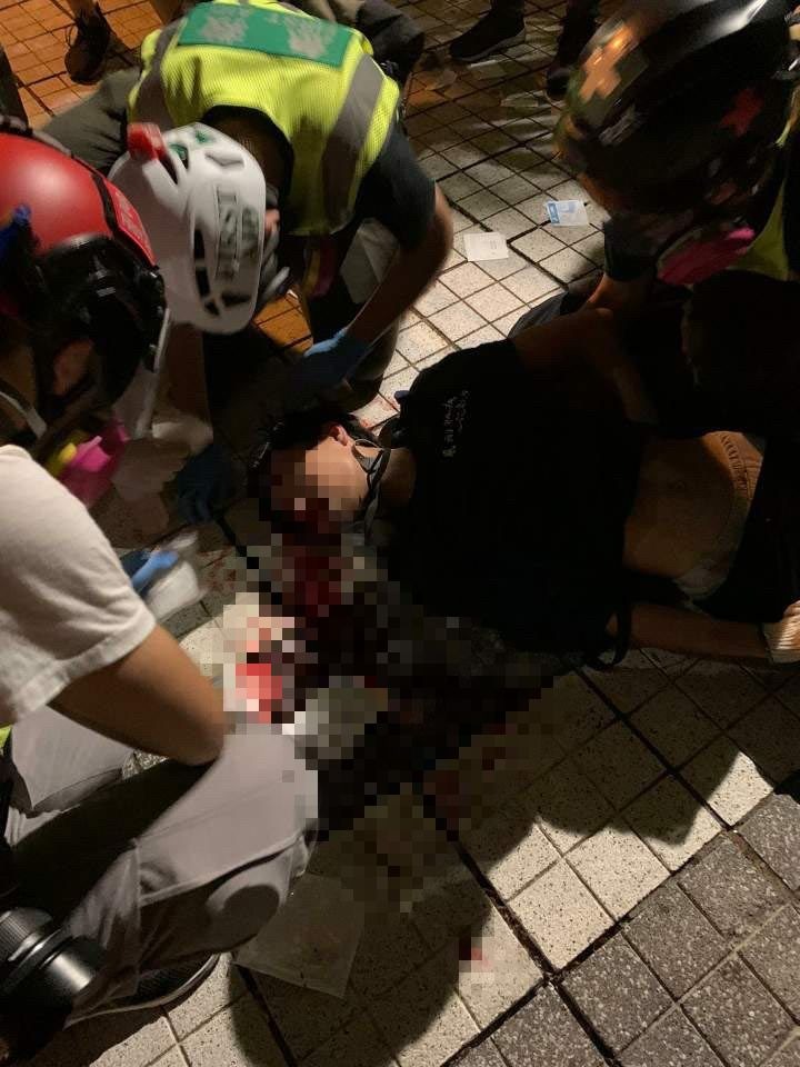 昨晚間在天水圍有一名15少年遭疑警方催淚彈射中頭部，導致顱骨骨折情況危殆。 圖 :	翻攝自香港連登討區