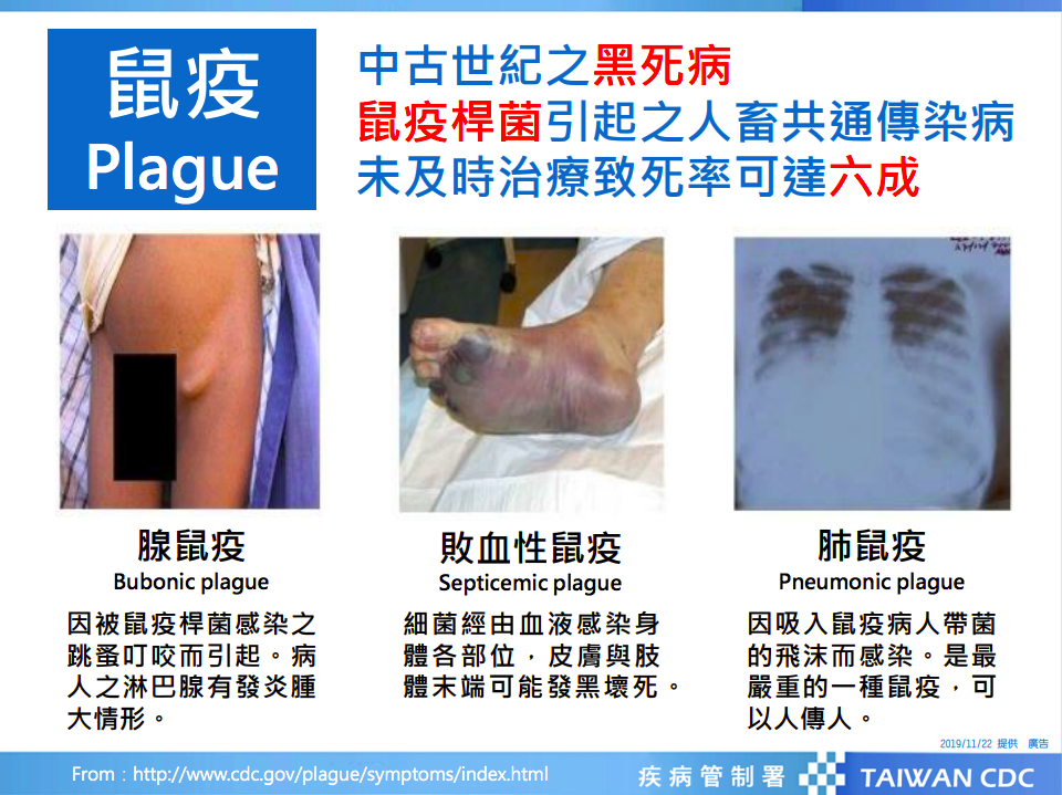鼠疫為人畜共通傳染病，如未經治療其致死率為30%至60％。 圖：疾管署／提供