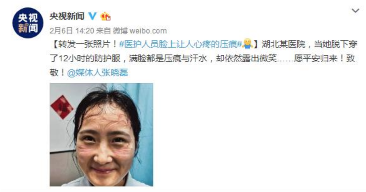 央視新聞早於2月6日PO出大陸護理師照片 圖：翻攝自「央視新聞」微博