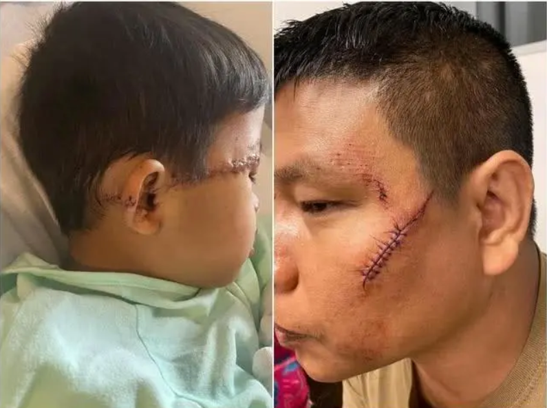 美國14日再發生一起泰國裔一家四口遭墨西哥裔男子攻擊，受害者嚴重毀容，其中的2名兒童受傷最嚴重。 圖：翻攝自環球時報