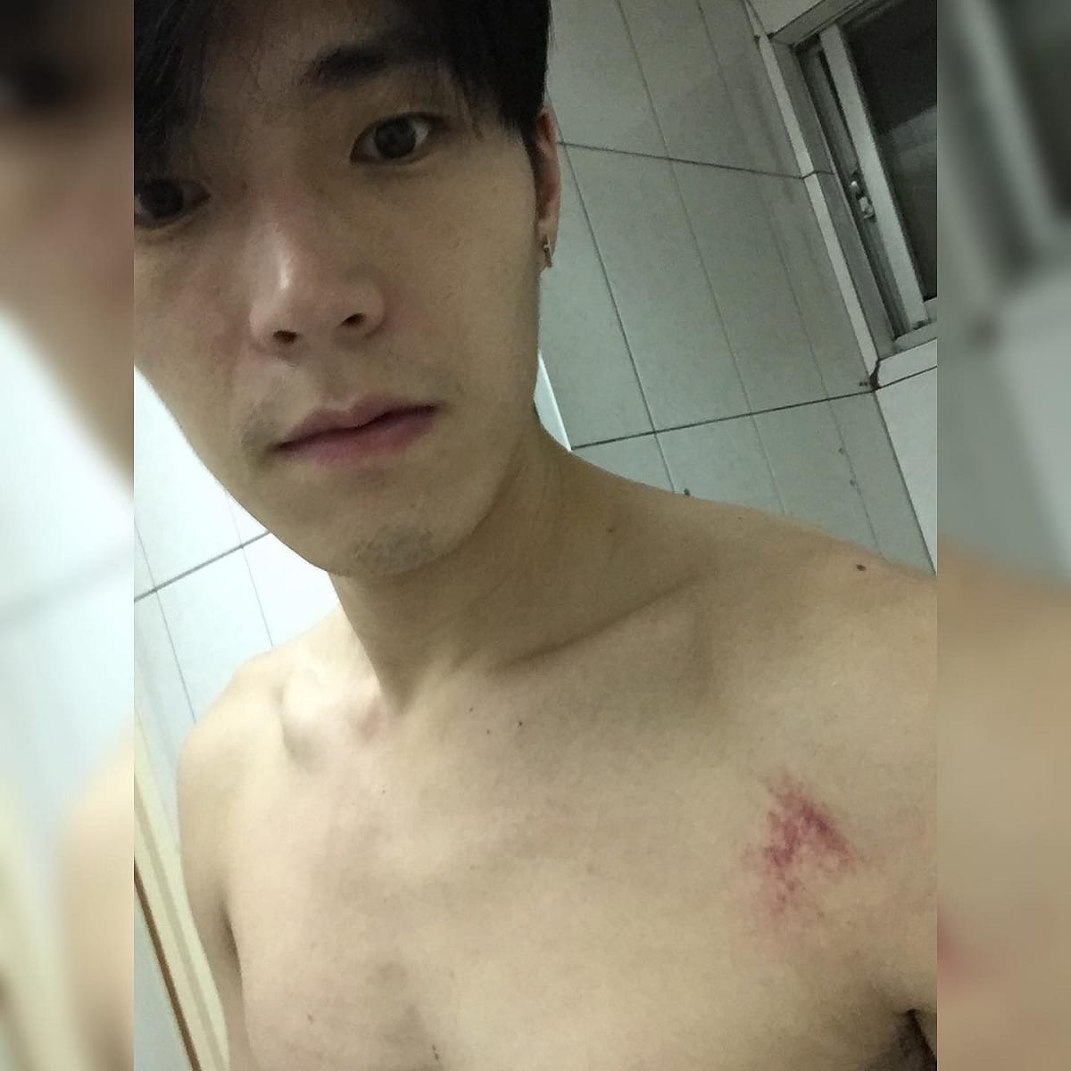 唐振剛出外景節目意外受傷。 圖：翻攝唐振剛粉專