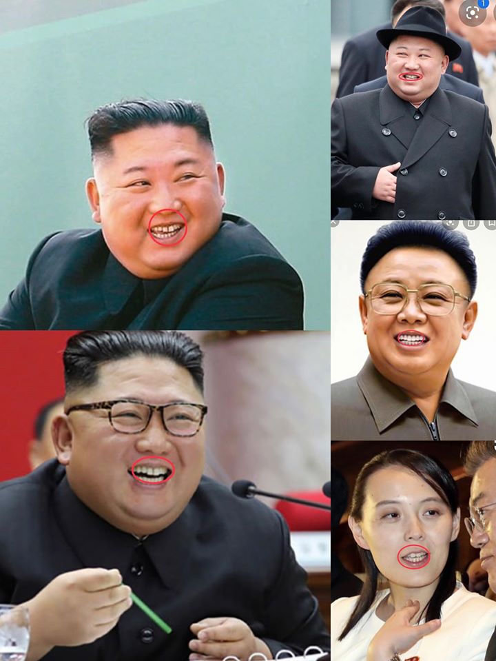 李正皓指出金氏家族有兔寶寶門牙一大特徵。 圖:翻攝李正皓臉書