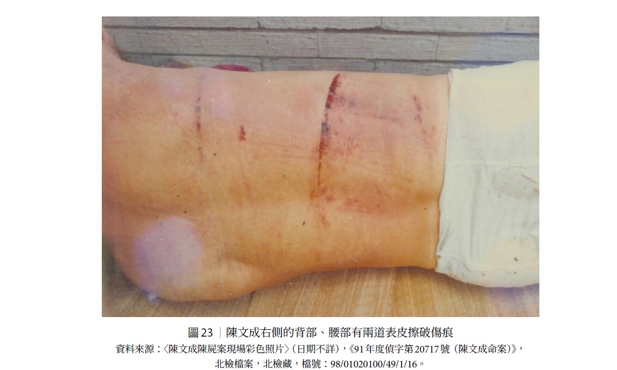 促轉會法醫鑑定，陳文成背後兩道致命傷痕，應是長條鈍狀物造成的。 圖：翻拍自陳文成調查報告