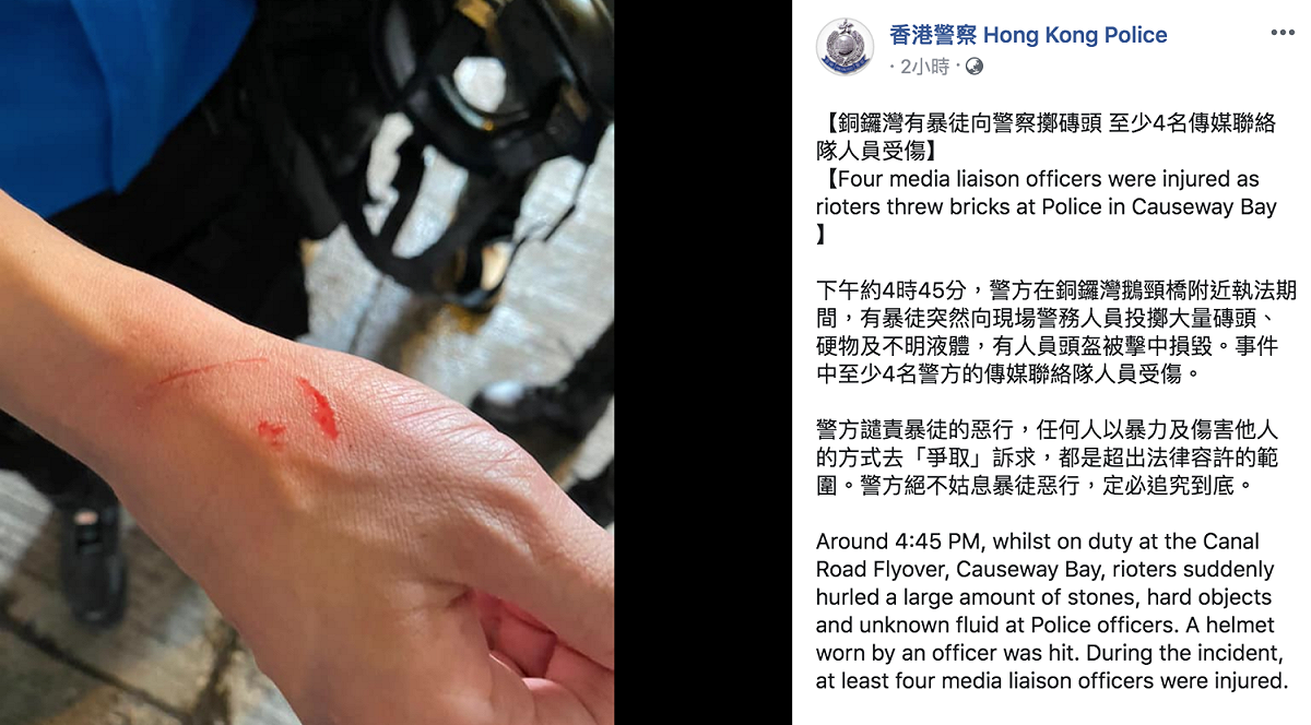 香港警察在臉書貼出警方傳媒聯絡隊人員受傷照片。 圖：翻攝自「香港警察」