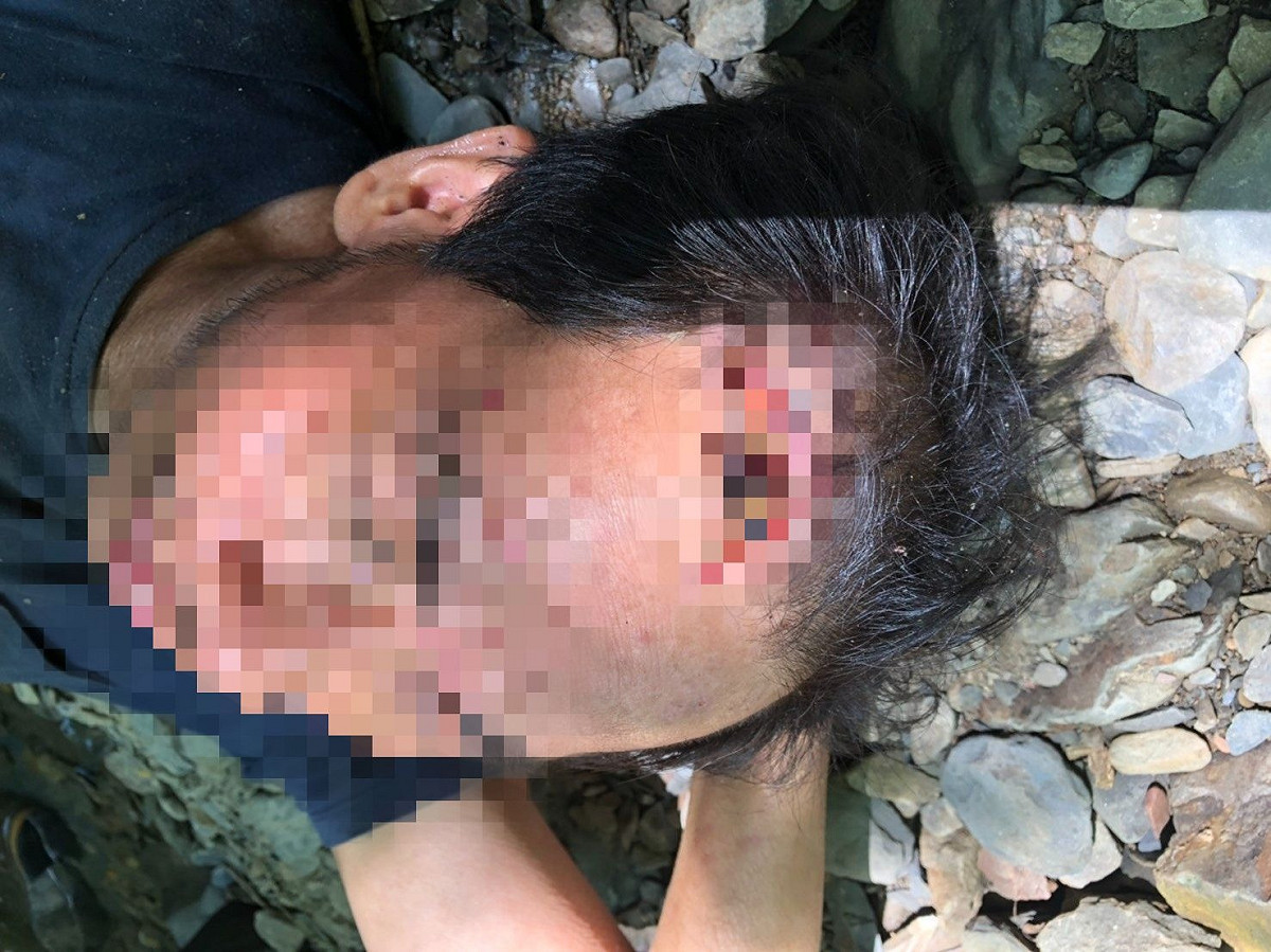 楊欣正頭部雖有撕裂傷，但意識仍清楚，目前已由搜救人員將人運送下山送醫。 圖 ：翻攝自網路