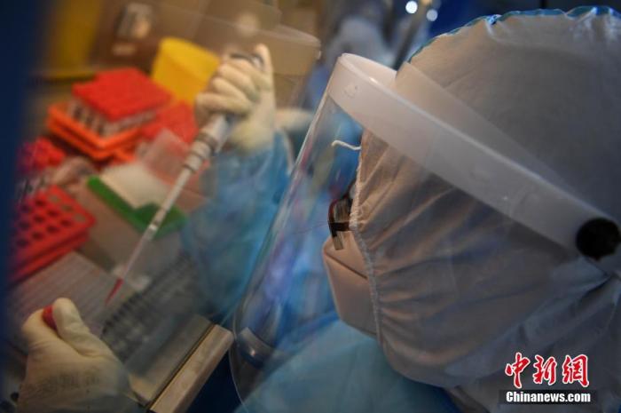 英國研究發現，武漢肺炎病毒可能會攻擊人類大腦。(示意圖) 圖 : 翻攝自中新網