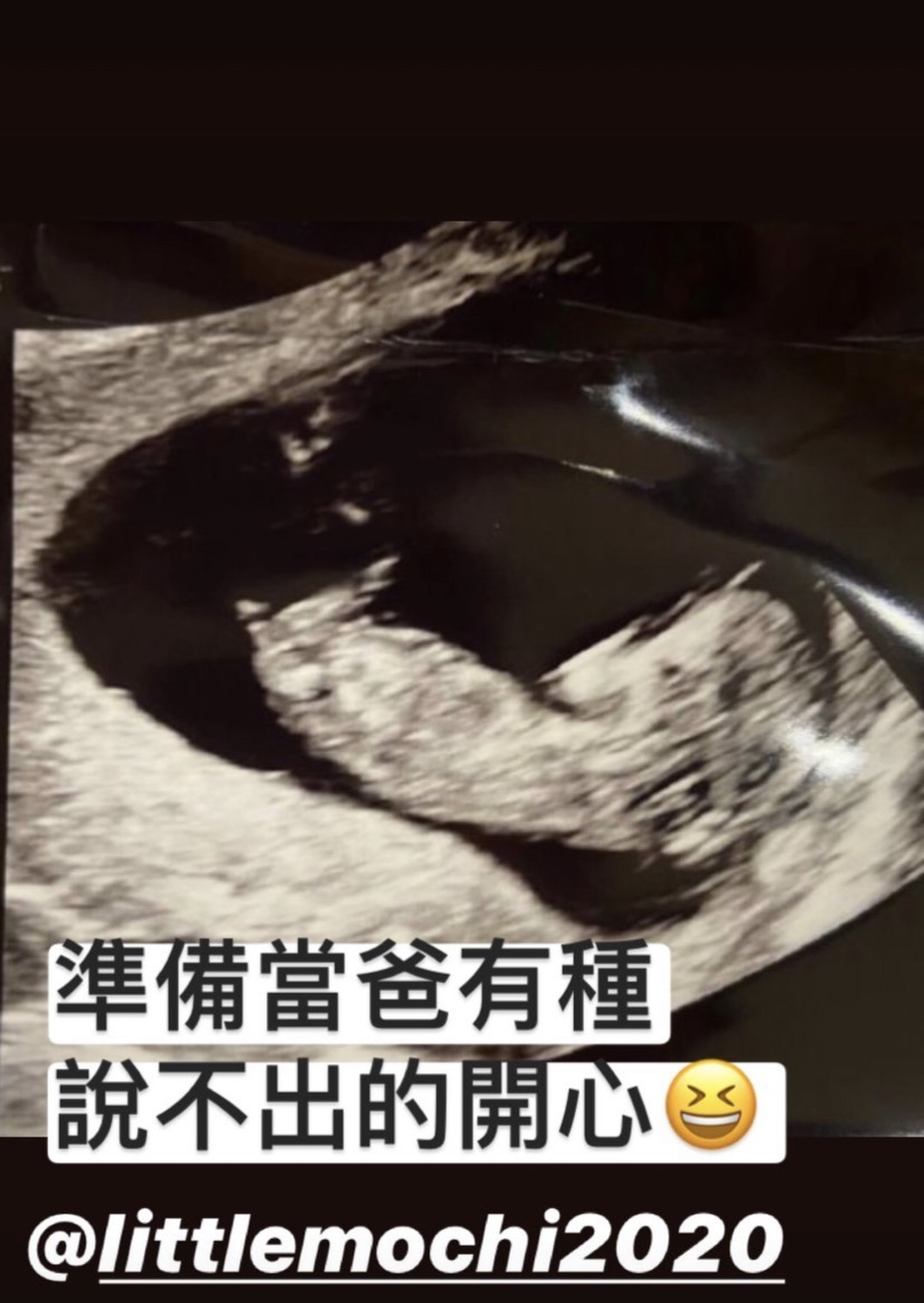 馬叔叔公佈小孩超音波照片。 圖：翻攝Instagram
