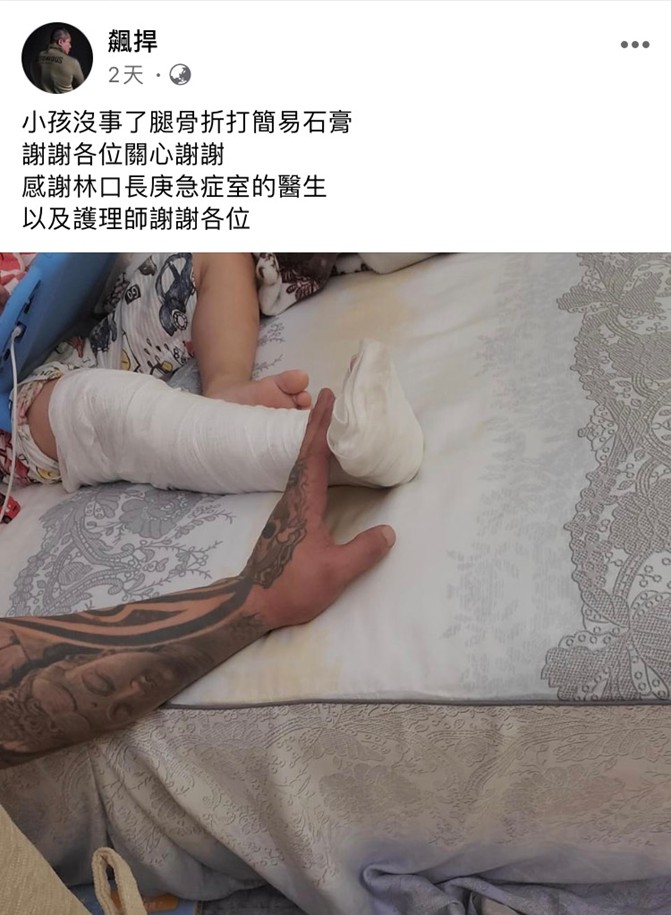 館長4歲兒意外被踩斷腿，讓硬漢館長好心疼。 圖：翻攝自館長成吉思汗臉書