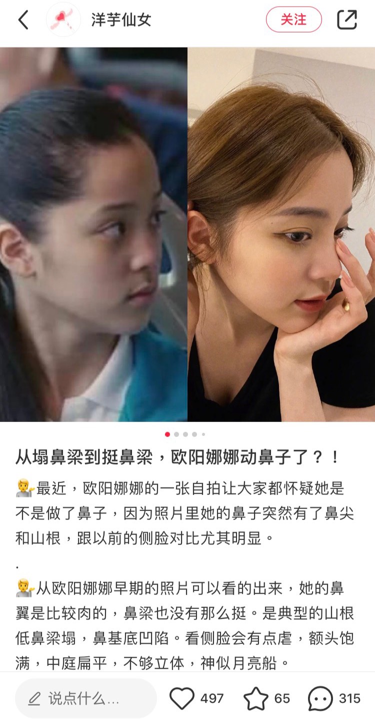 有網友發出對比圖，懷疑歐陽娜娜鼻子是不是整形。 圖：翻攝自洋芋仙女小紅書