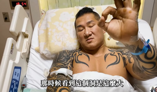 館長表示：「我並沒有甚麼自導自演，或者覺得自己生命沒有危險，你有看到這些開口了嗎？沒縫的時候一個洞這麼大。」 圖：翻攝館長成吉思汗YouTube