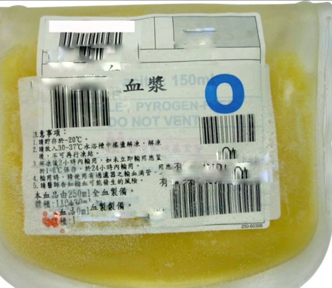 世界各地目前都在研究「血漿療法」，日本也將進入臨床實驗，圖為血漿。 圖：翻攝自台中捐自中心粉絲頁