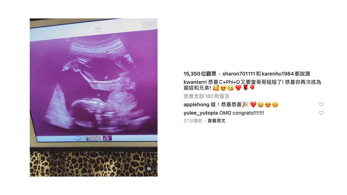 今日關穎貼出超音波照，公布喜懷第四胎。 圖：翻攝自關穎IG