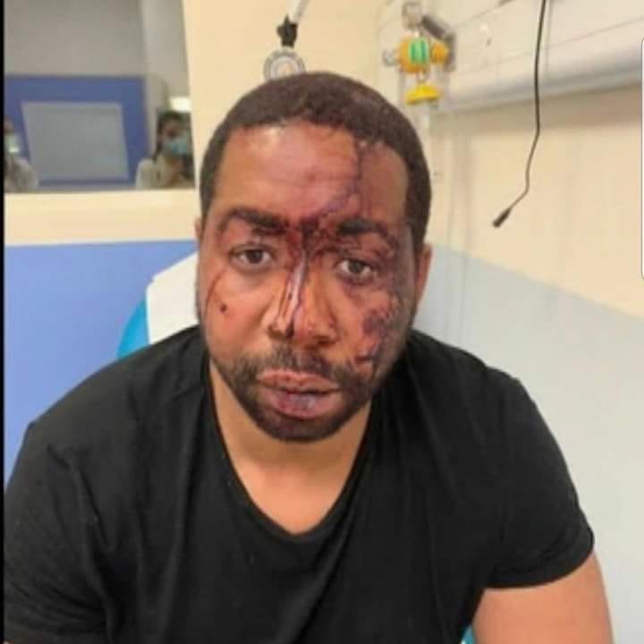 非裔音樂製作人澤克勒日前在街頭慘遭法國警察毆打，消息一出引起外界譁然，法國總統馬克宏今日也表示，感到「非常震驚」。 圖：翻攝自Kant Lebeau臉書