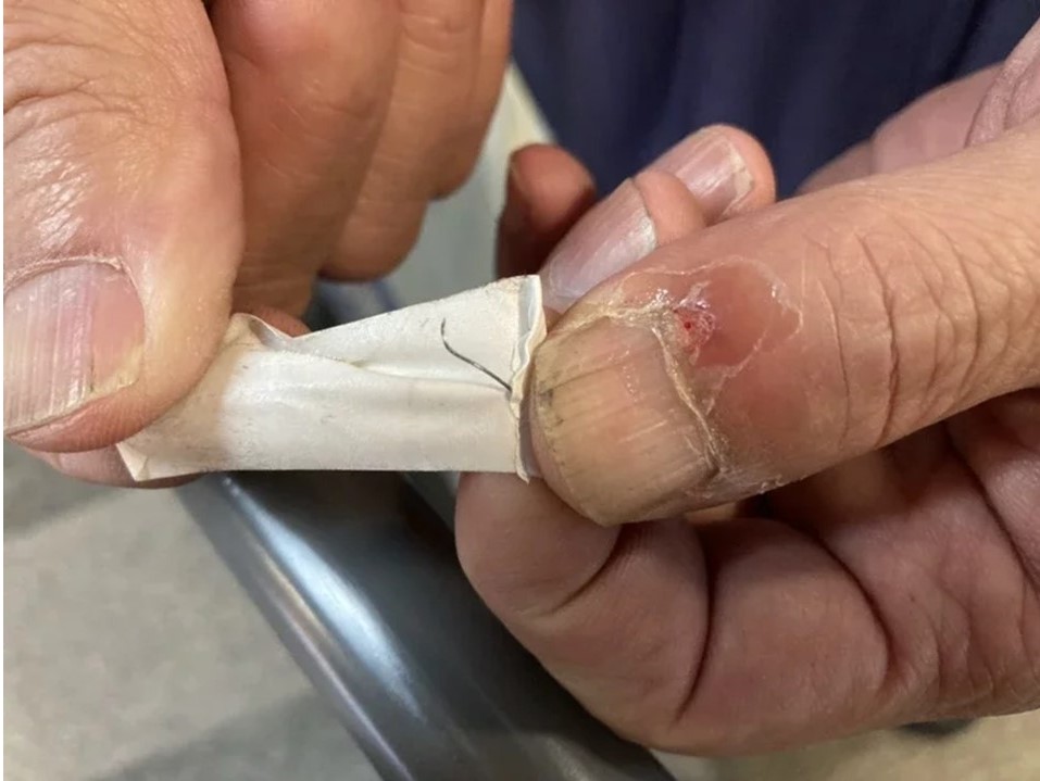 台鐵局表示，廠商查看後判斷為外力介入的針狀物，並非設備原有物。 圖：台鐵局／提供