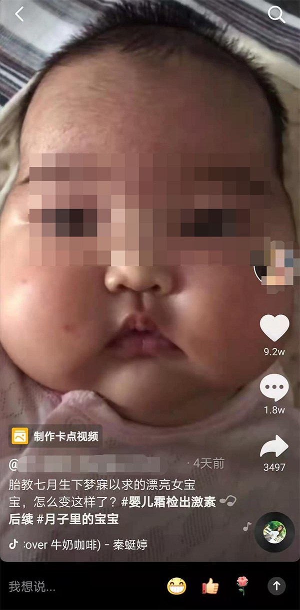 多名家長反映嬰兒在使用「戒之館」品牌嬰親霜後出現臉部腫大、多毛、發育遲緩等「大臉娃娃」症狀。 圖：翻攝澎湃新聞