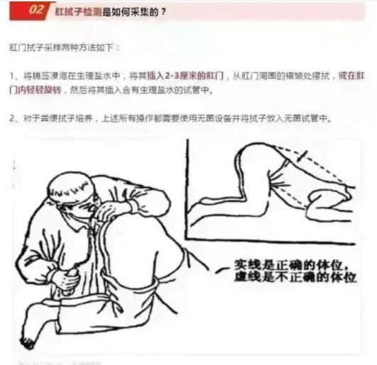 中國網路上流傳許多肛篩的說明圖文。 圖：翻攝微博