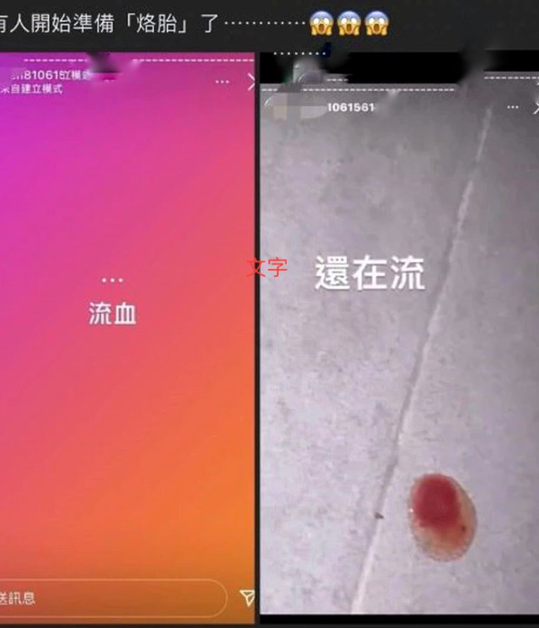 今罔腰於ig貼出限時動態「流血」，雖嚇壞不少人，但則有網友指出這是罔腰為烙胎(流產)的前奏。