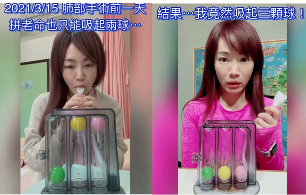 蕭彤雯發了一段近2分鐘的短片記錄術後生活。