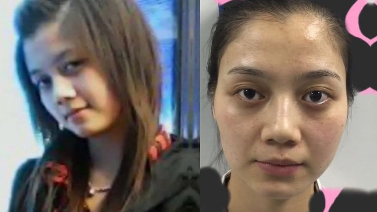 青青公開自己整型前的舊照，嚇壞網友。 圖：翻攝自微博