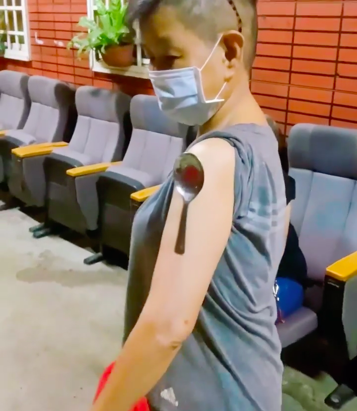 歌手賴銘偉母親施打莫德納疫苗後手臂竟可以吸附鐵湯匙，引發網友熱議。 圖：取自賴銘偉臉書