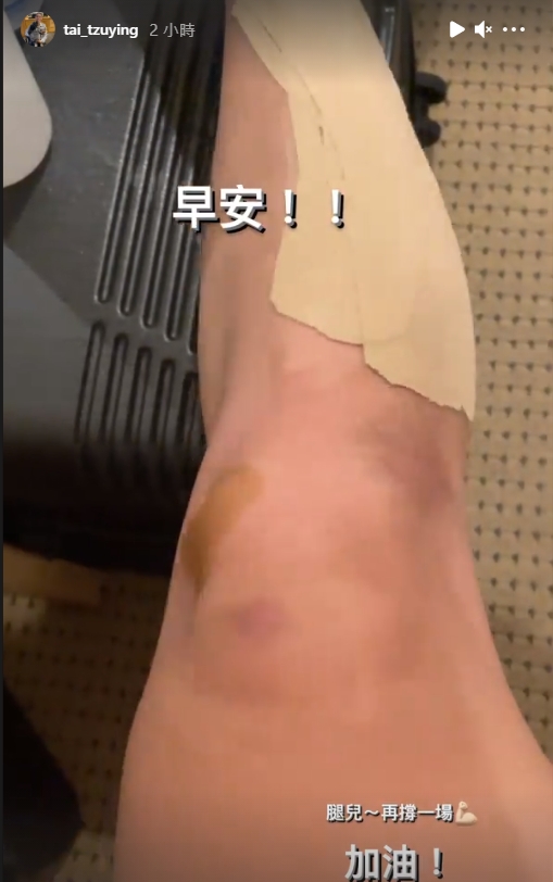 戴資穎在Instagram限時動態貼出自己的小腿照，並向小腿喊話:「腿兒，再撐一場，加油」！ 圖：取自戴資穎臉書專頁