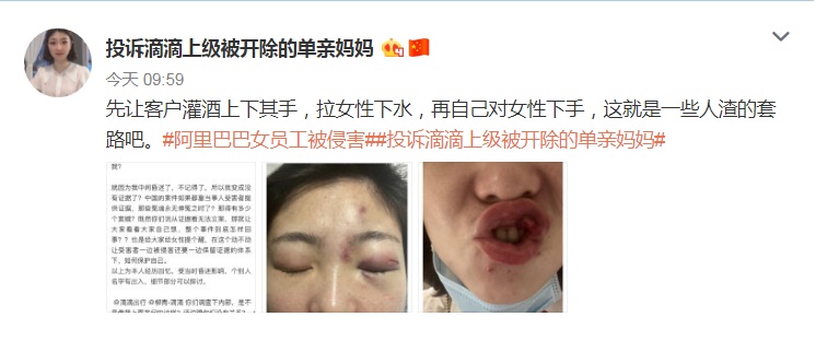 微博「投訴滴滴上級被開除的單親媽媽」帳號控訴中國叫車平台「滴滴出行」也有上司強迫應酬飯局，灌醉後施暴性侵，貼出當時臉傷照片。 圖：翻攝投訴滴滴上級被開除的單親媽媽微博