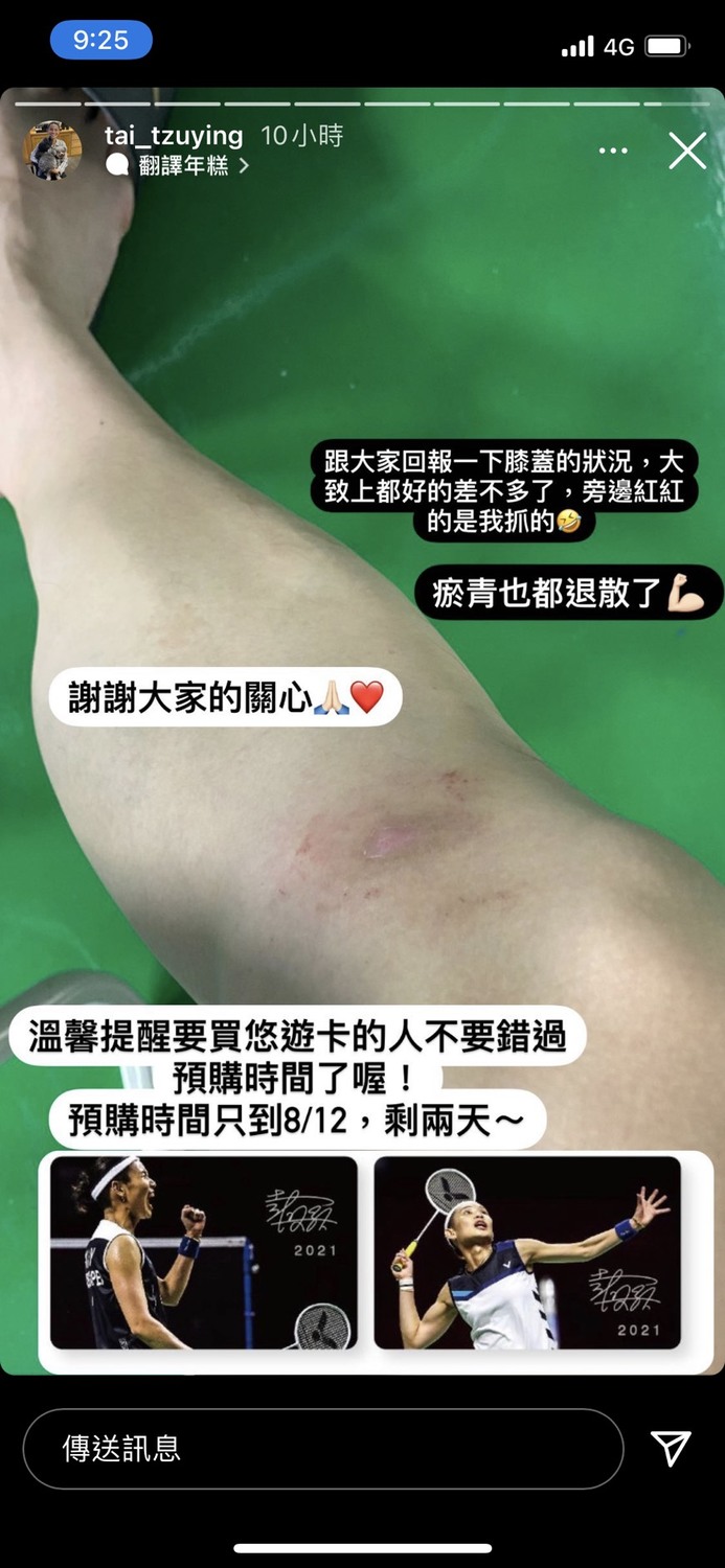 戴資穎PO出膝蓋的最新狀況，感謝大家關心。 圖：擷取自戴資穎IG