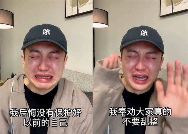 整形失敗讓金大威一度淚崩「本來是想變好看的，後面變成了一個醜八怪」。 圖：擷取自抖音／金大威Abel