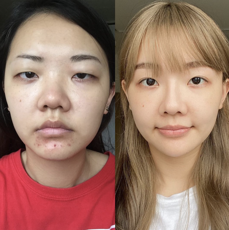 福爾思庭大方分享整型心得。 圖：翻攝IG／福爾思庭