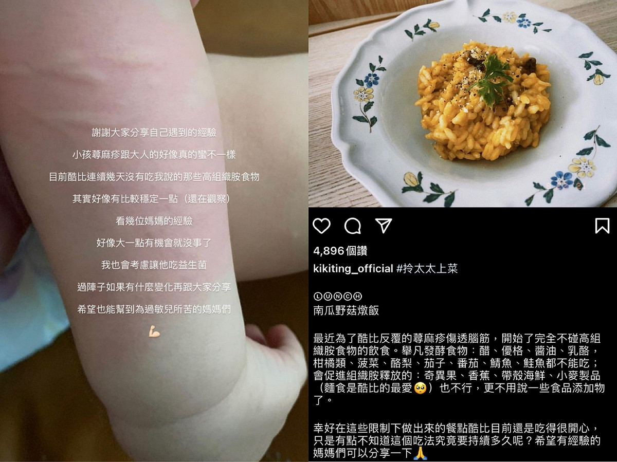 丁文琪昨日在社群平台上透露兒子最近反覆出現蕁麻疹。 圖：翻攝自IG