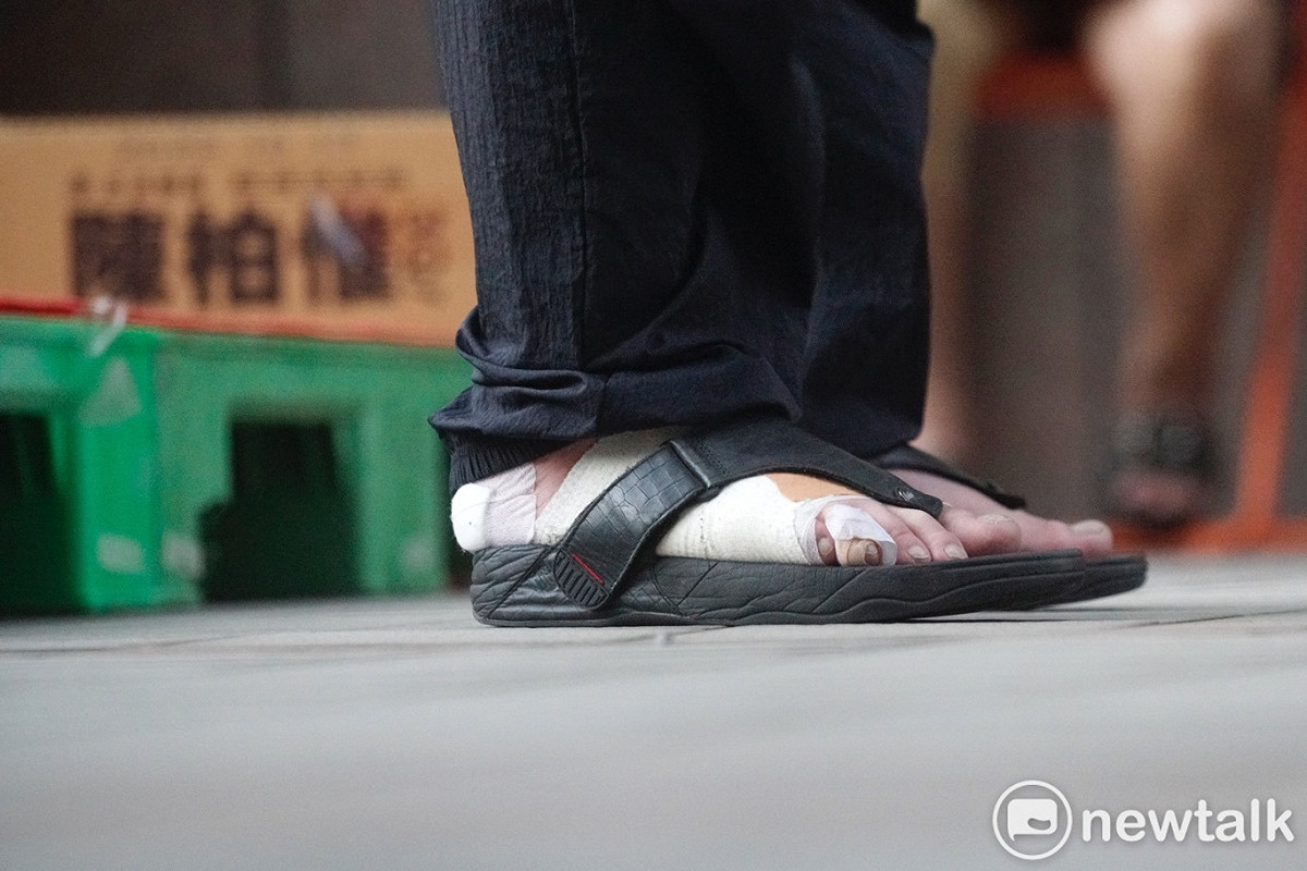 陳柏惟右腳底摩破皮，下午穿涼鞋參加反罷免活動，右腳也包上紗布。 圖：張良一/攝