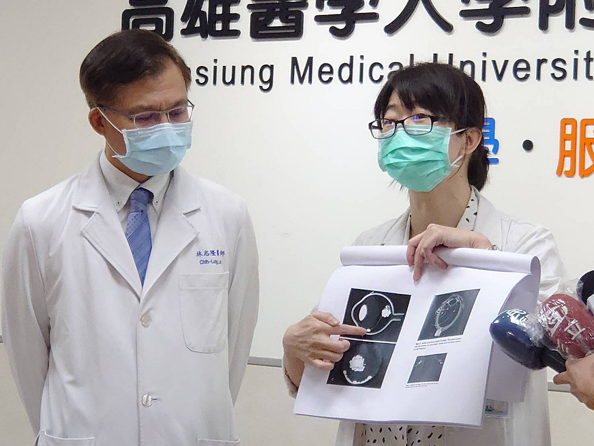 高醫副院長林志隆(左)與張童的主治醫師廖優美。 圖：高醫公關室提供