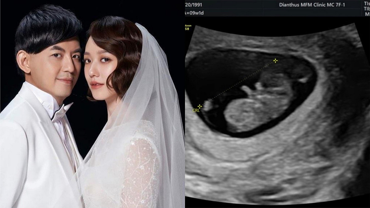 黃子佼和孟耿如愛情長跑7年，終於在去年3月登記結婚，本月16日女方在社群上公布懷孕的喜訊。 圖：翻攝自臉書