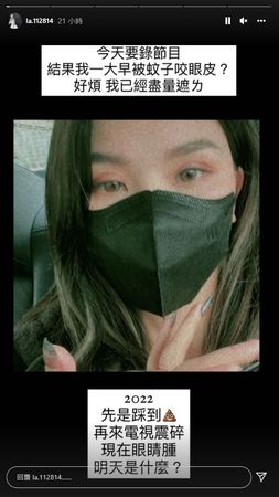 蕾菈眼皮被蚊子叮。 圖：翻攝自蕾菈IG(@la.112814)