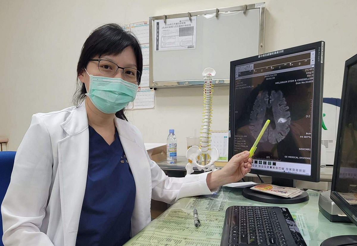 中榮嘉義分院神經內科主治醫師田怡婷表示，抽菸及三高族群，容易造成腦中風。 圖：中榮嘉義分院/提供