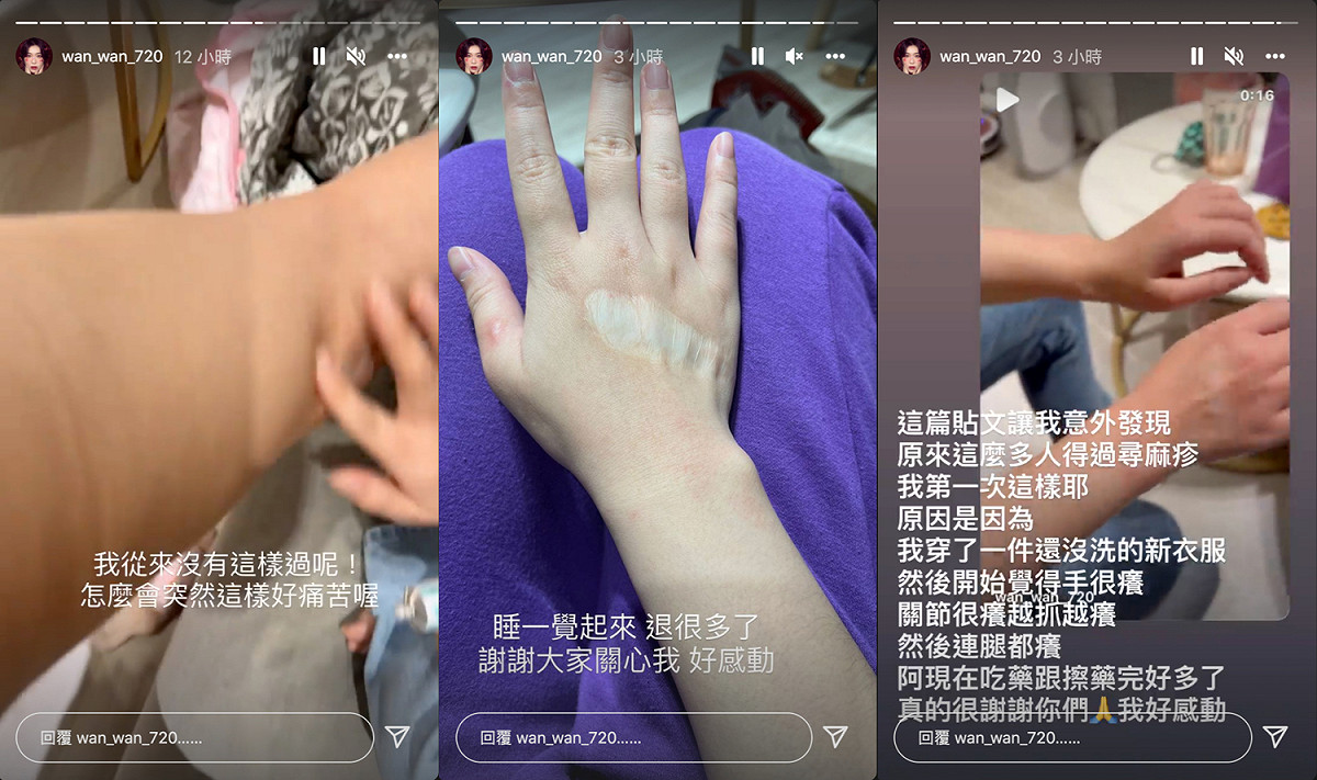 宛宛兒透露就醫後，情況已好轉。 圖：翻攝自宛宛兒IG(@wan_wan_720)