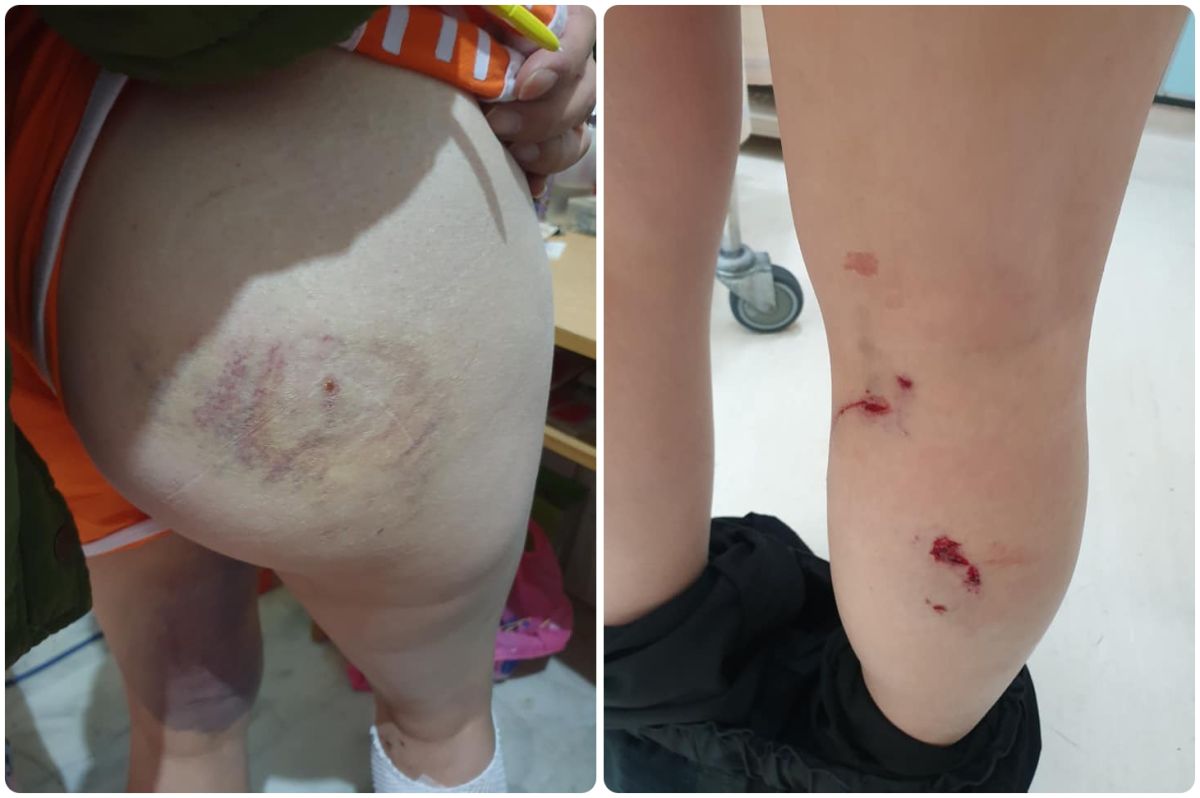 ▲王姓女送貨員配送宅配時被客人家的3隻邊境牧羊犬咬得遍體鱗傷，而飼主事發後的態度更是讓人十分生氣。 圖／爆廢公社公開版臉書