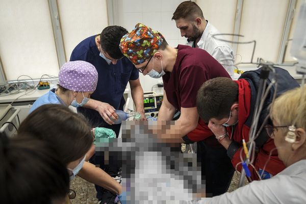 女童不治，醫師痛罵：「讓普丁來看看這一幕，讓他好好看看這些孩子的眼睛，我真希望他去死」 圖：美聯社／達志影像