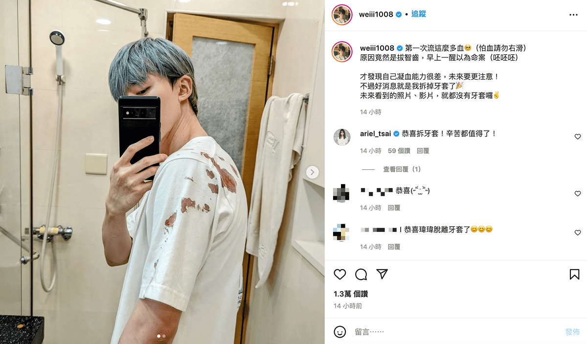瑋瑋拔完智齒後大爆血。 圖：翻攝自瑋瑋IG(@weiii1008)