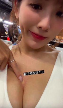 壯壯遭蚊子叮。 圖：翻攝自壯壯IG(@ula_shen_)