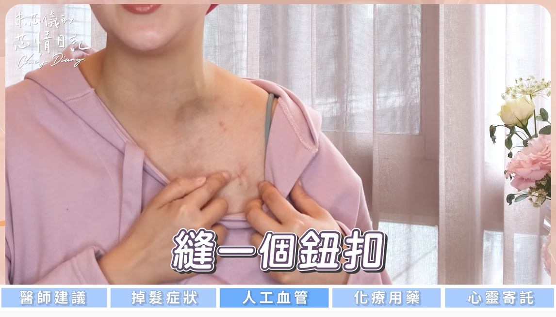 朱芯儀秀出裝在身體裡的「人工血管」。 圖：翻攝自YouTube/朱芯儀的芯情日記Chu's Diary