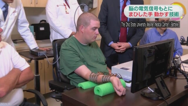 美國俄亥俄州大學開發出新技術，能使脊髓損傷者隨心所欲，讓手腳依著自己的意志運動。 圖：翻攝自NHK網站