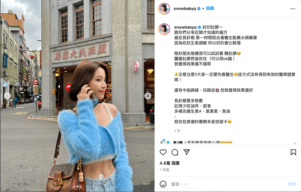 蔡瑞雪分享「消針眼」偏方。 圖：翻攝自蔡瑞雪IG(@snowbabyq)