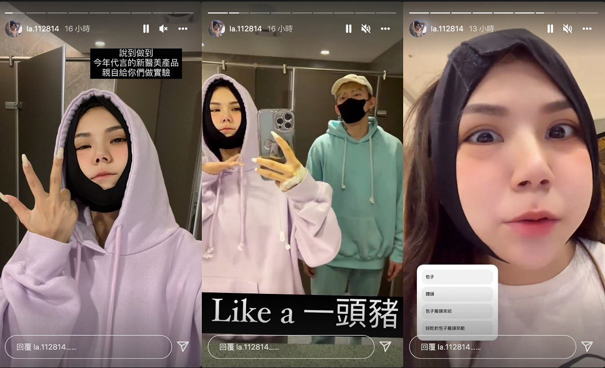 蕾菈形容術後的自己腫的像「豬頭」。 圖：翻攝自蕾菈IG(@la.112814)